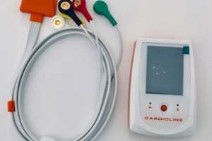 Holter cardiaco, a cosa serve
